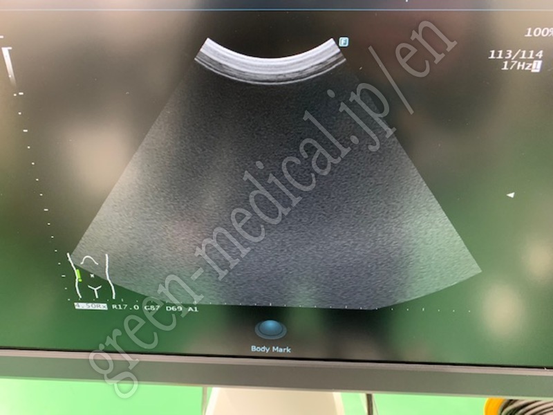 6.○超音波診断装置(カラードプラ)