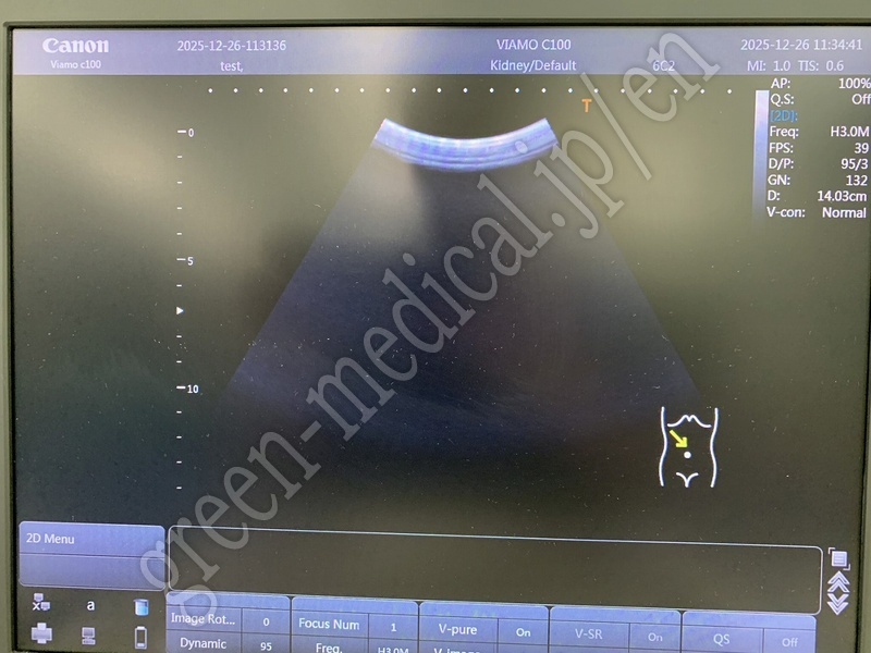 6.〇 超音波診断装置