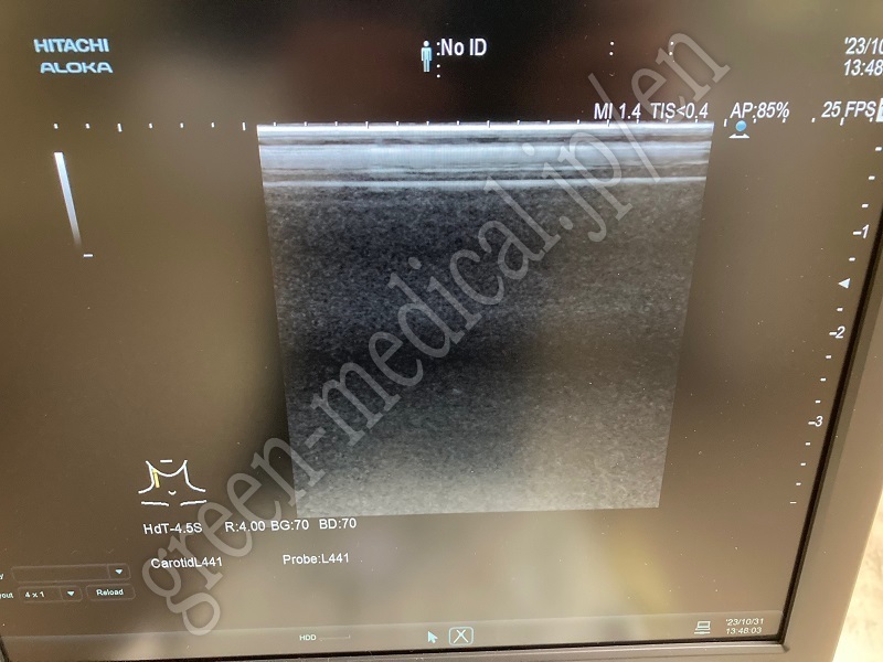7.〇超音波診断装置 ＜プローブ3本構成＞