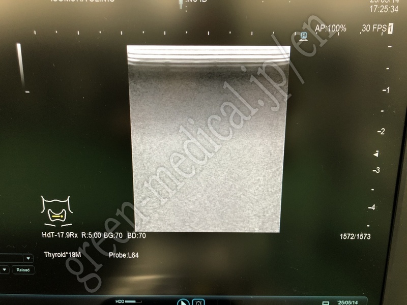 7.○超音波診断装置
