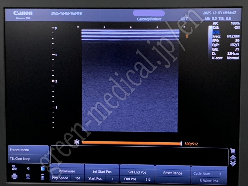 7.〇 超音波診断装置