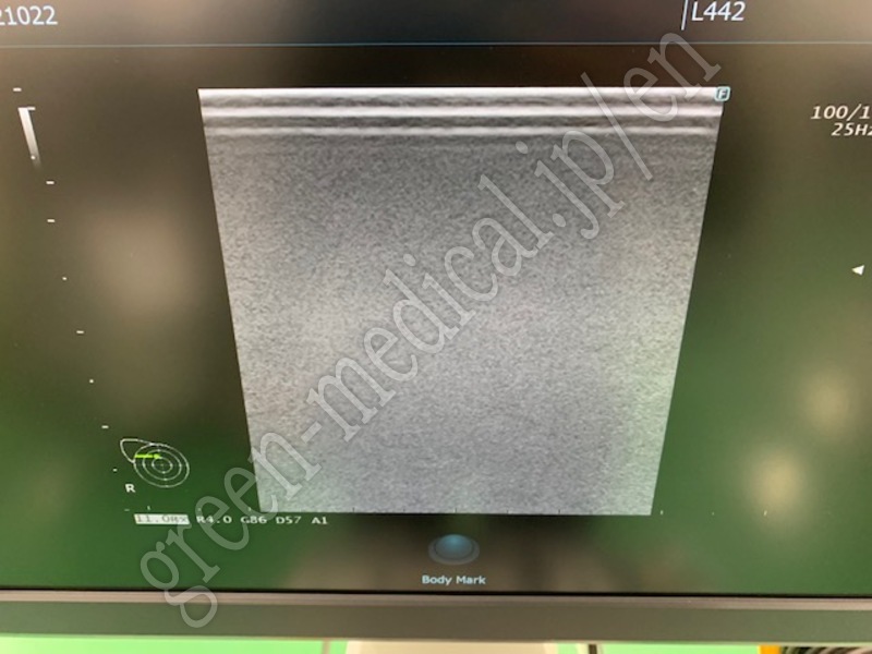 7.○超音波診断装置(カラードプラ)