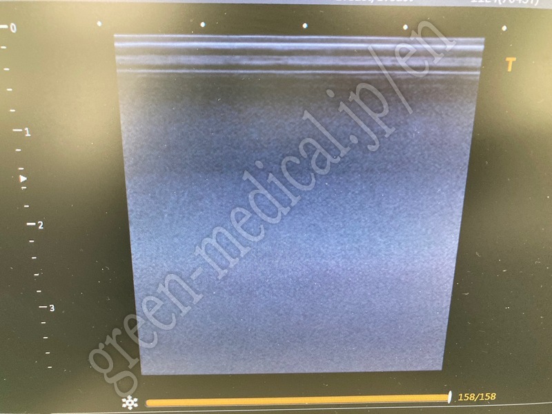 7.〇 超音波診断装置