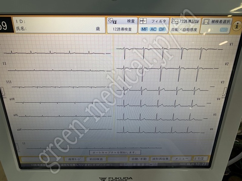 8.○多機能心電計