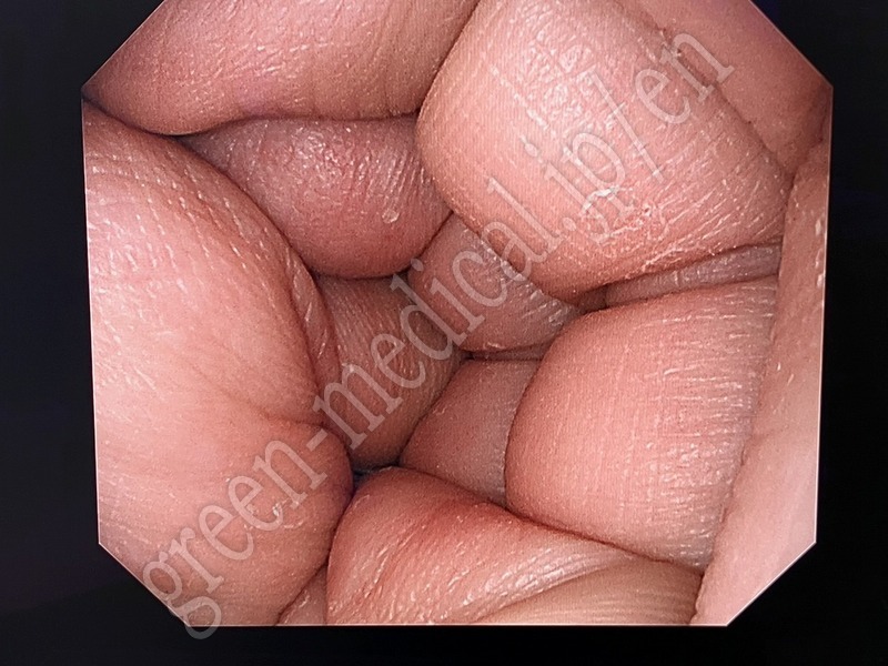 8.〇上部消化管汎用ビデオスコープ