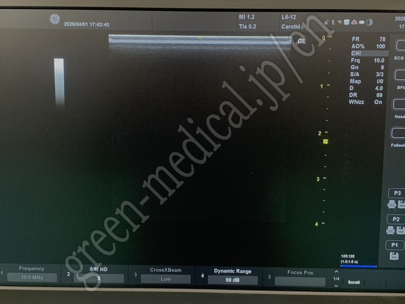 8.〇 超音波診断装置(カラー）