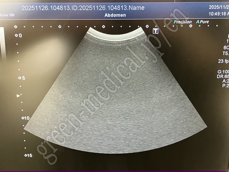 8.○ 超音波診断装置（カラードプラ）