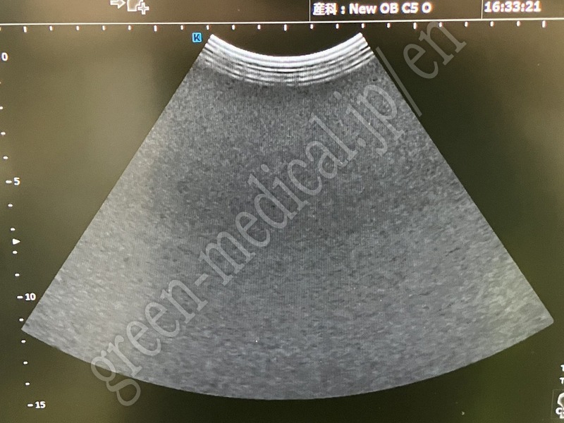 8.○ 超音波診断装置（カラー）