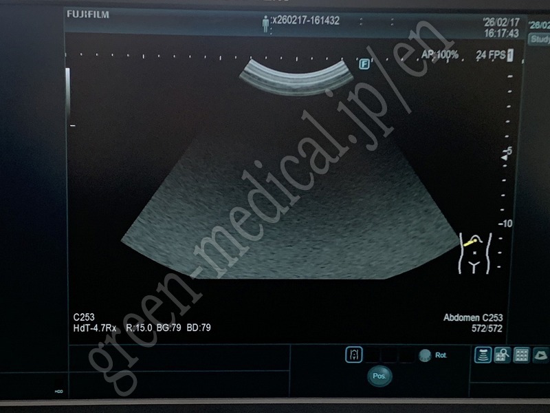 8.○超音波診断装置