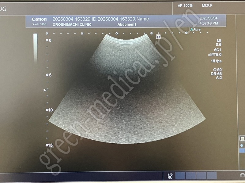 8.〇 超音波診断装置