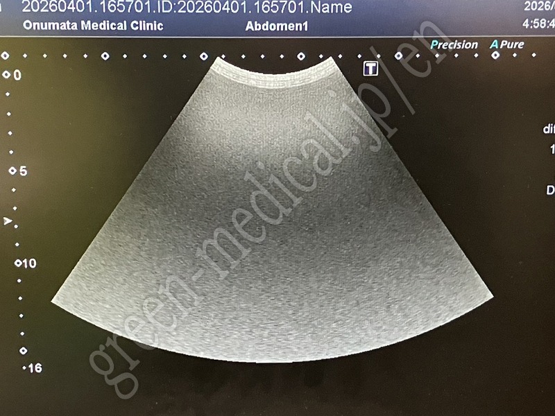 8.○超音波診断装置 ＜プローブ3本構成＞