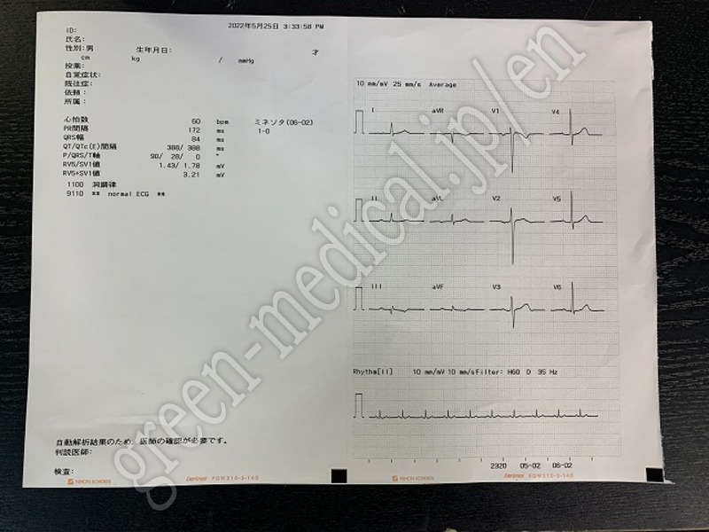 9.○ 解析機能付心電計