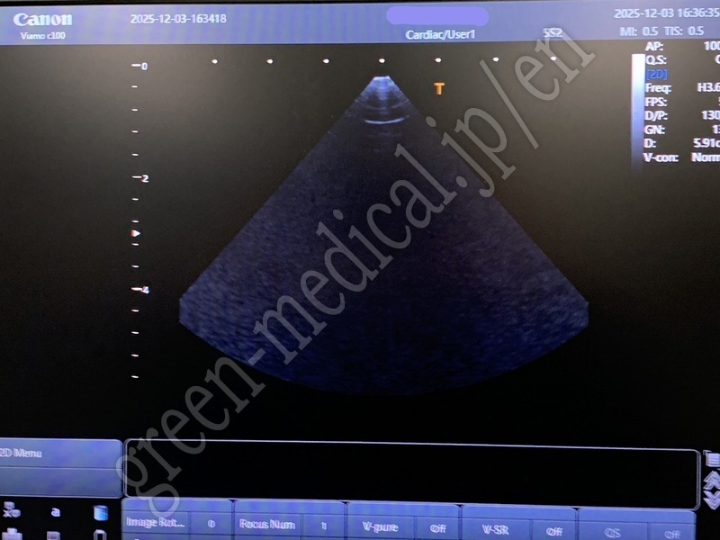 9.〇 超音波診断装置