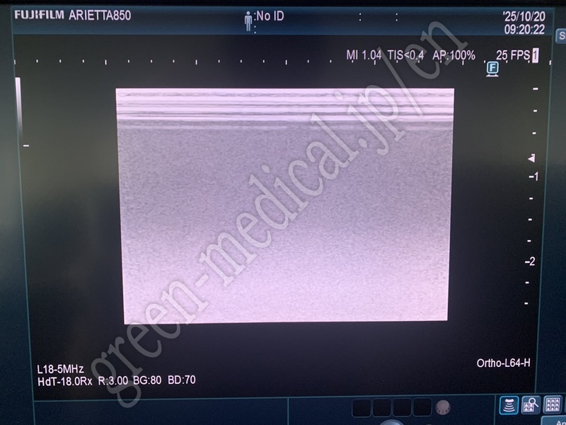 9.【動物病院向け】超音波診断装置