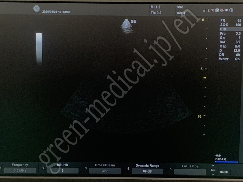 9.〇 超音波診断装置(カラー）