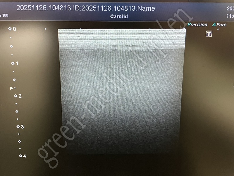 9.○ 超音波診断装置（カラードプラ）