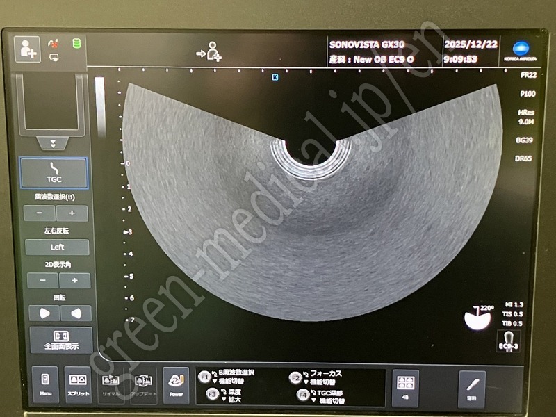 9.○ 超音波診断装置（カラー）