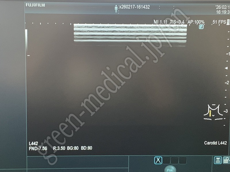 9.○超音波診断装置