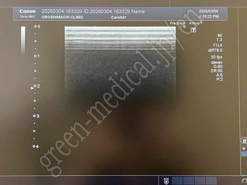 9.〇 超音波診断装置