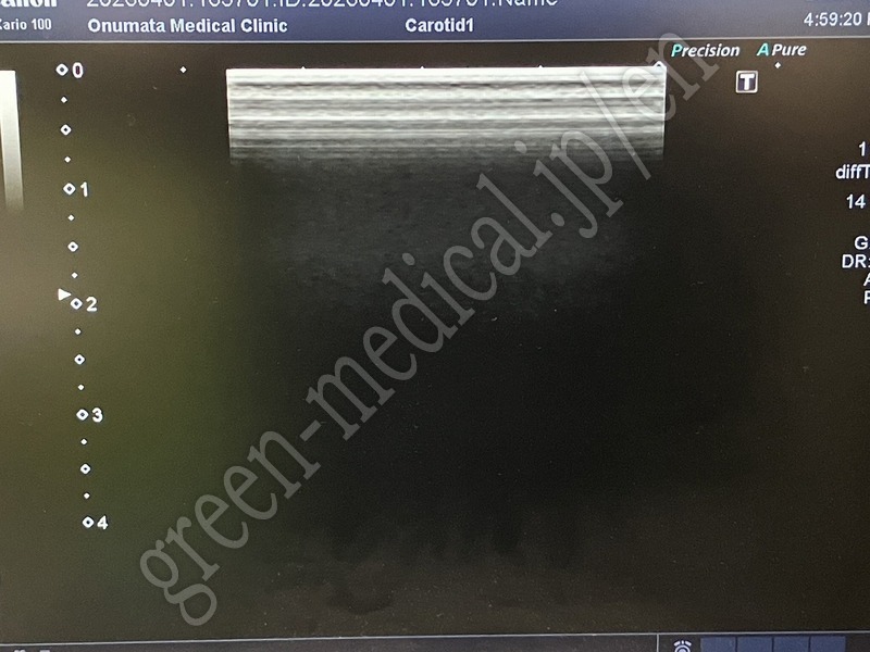 9.○超音波診断装置 ＜プローブ3本構成＞