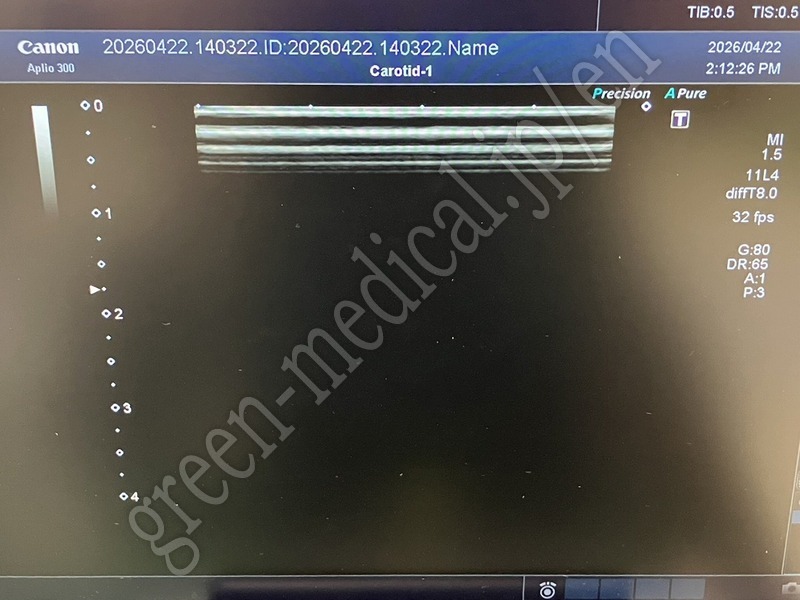 9.○ 超音波診断装置
